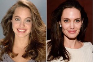 Angelina Jolie avant et apres